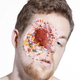 Illustration for article titled Photographs of gruesome injuries made out of cake and ice cream
